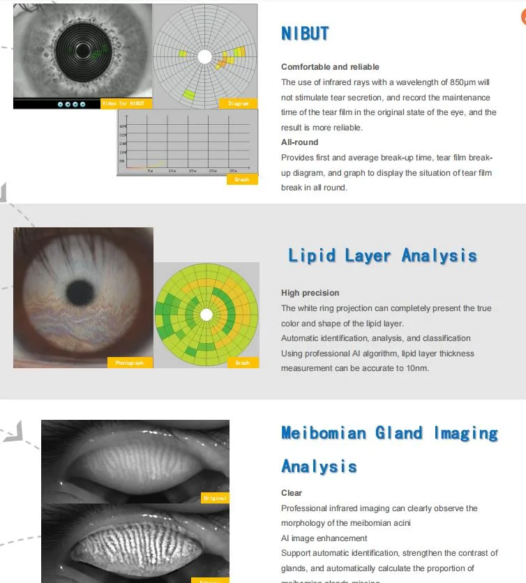 Ocular Surface Analyzer for Dry Eye Examination&Analysis Price for Sale