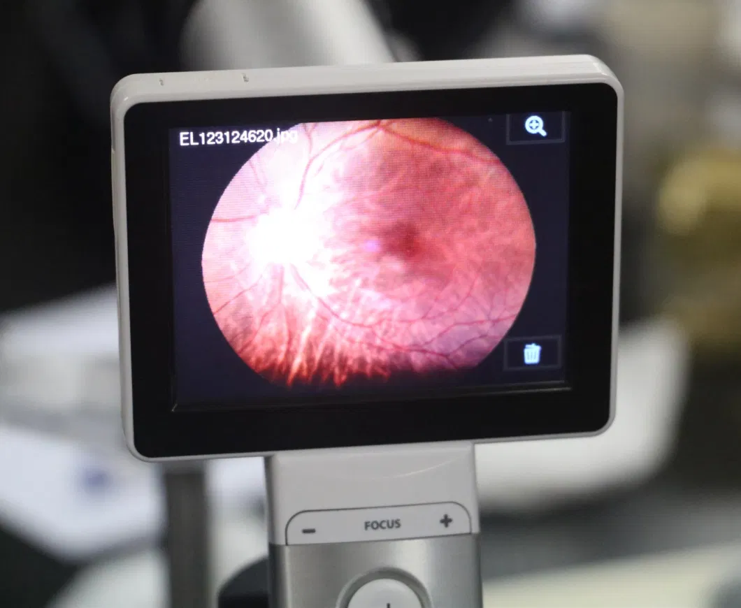 Miis Retinal Camera Horus Fundus Camera with Favorable Price