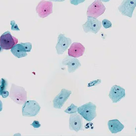 광학 안과학을 위한 고품질 안과 초음파 디지털 A/b 스캐너 Retiwave 1000